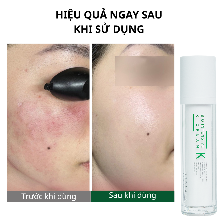 bio intensive k cream