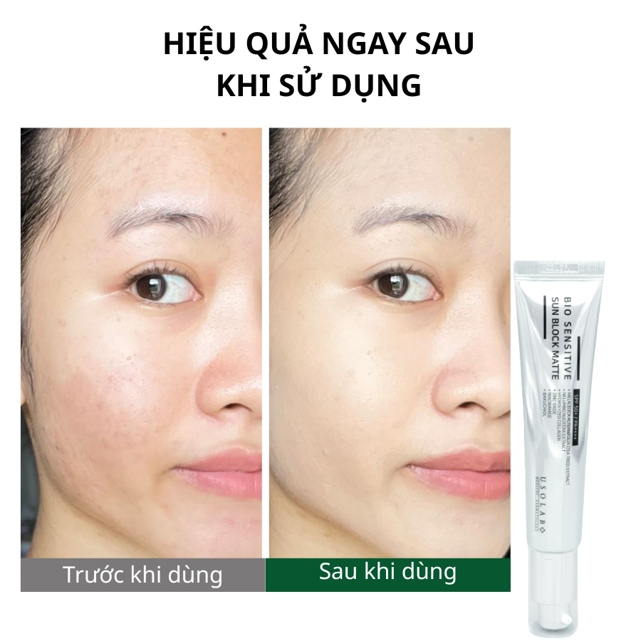 BIO SENSITIVE SUN BLOCK MATTE
