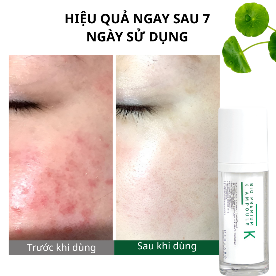 Bio Premium K Ampoule