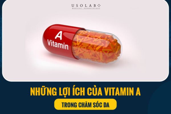 Bị mụn nội tiết uống vitamin gì để giảm mụn và cân bằng nội tiết? - Ảnh 3