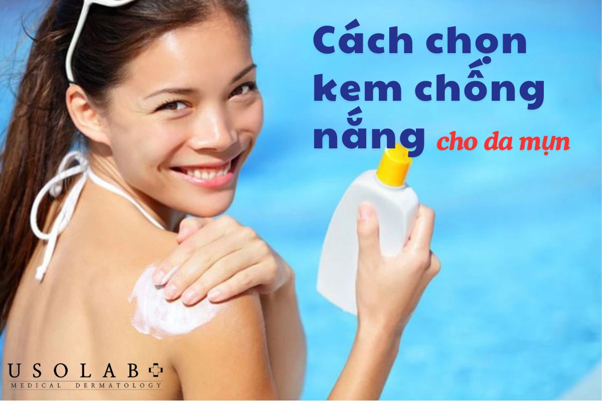 Cách bôi kem chống nắng không bị mụn giúp bảo vệ làn da mịn màng - ảnh 2