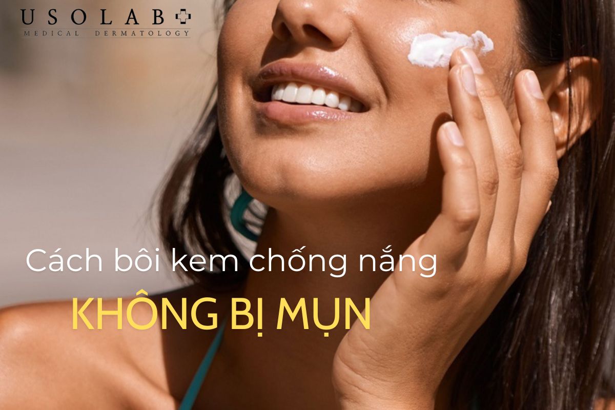 Cách bôi kem chống nắng không bị mụn giúp bảo vệ làn da mịn màng - ảnh 3