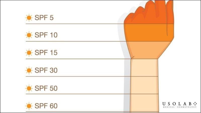 Chỉ số UV bao nhiêu thì bôi kem chống nắng để bảo vệ làn da? - ảnh 2