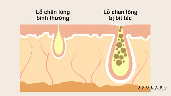 Sử dụng phấn phủ có hại da không? Bảo về làn da trước lớp makeup - ảnh 2