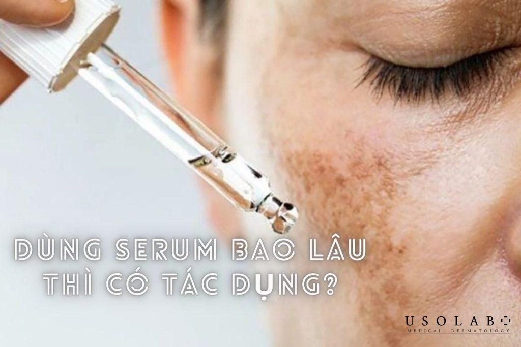 Dùng serum bao lâu thì có tác dụng