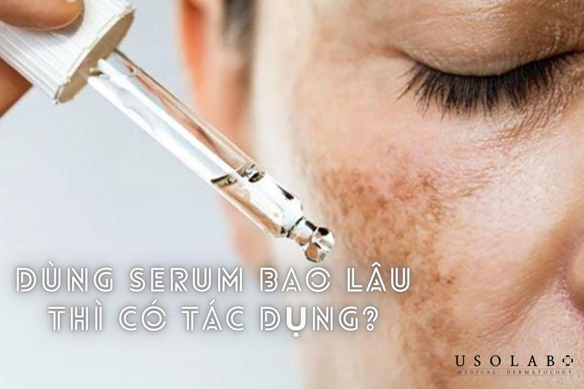 Dùng serum bao lâu thì có tác dụng? Tần suất sử dụng thế nào - ảnh 1