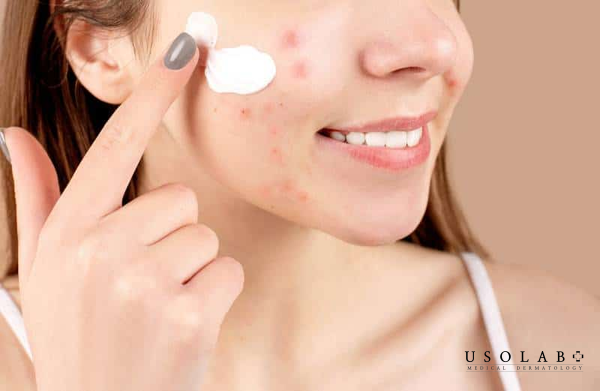 Quy trình skincare cho da dầu mụn ban đêm đúng chuẩn, hiệu quả - ảnh 1