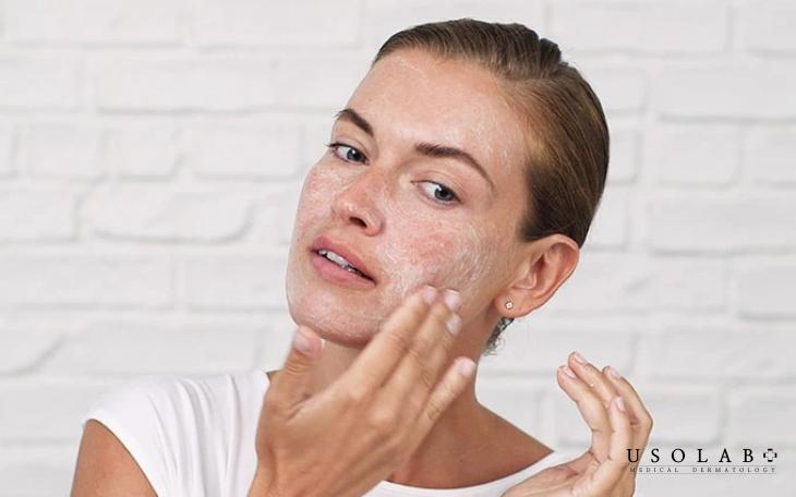 Quy trình skincare cho da dầu mụn ban đêm đúng chuẩn, hiệu quả - ảnh 3