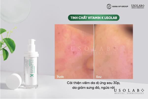 Công dụng của tinh chất K Ampoule