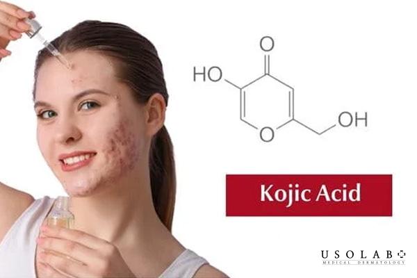 Kojic Acid là hoạt chất làm sáng da tự nhiên