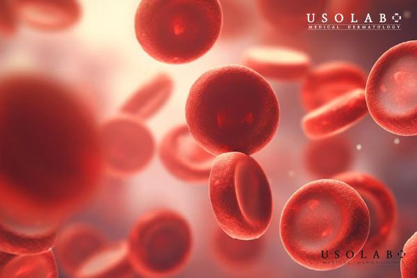 Vitamin K giúp cơ thể kiểm soát chảy máu, ngăn ngừa bầm tím