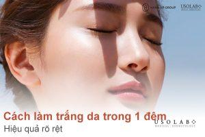 Cách chọn kem chống nắng phù hợp với từng loại da để bảo vệ da tối ưu