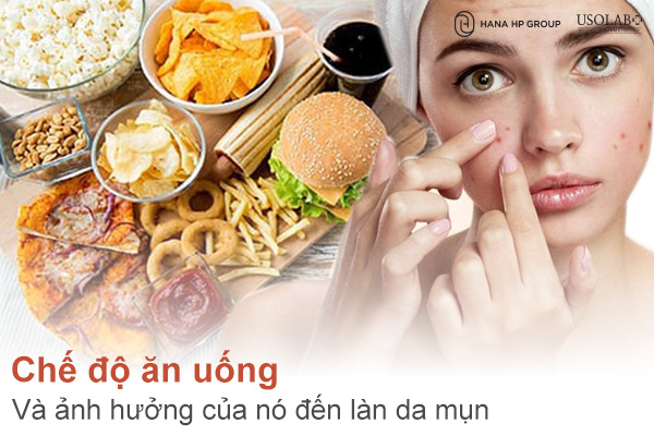 Chế độ ăn uống và ảnh hưởng của nó đến làn da mụn: Ăn gì để da khỏe, hạn chế mụn?