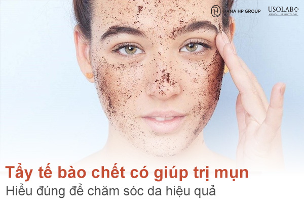 Tẩy tế bào chết có giúp trị mụn không? Hiểu đúng để chăm sóc da hiệu quả