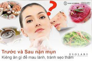 Trước và Sau nặn mụn kiêng ăn gì để mau lành, tránh sẹo thâm? 