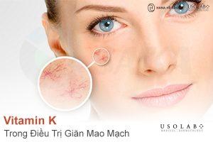 Vitamin K trong Điều Trị Giãn Mao Mạch – Giải Pháp Củng Cố Thành Mạch Máu