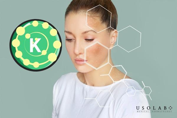 Vitamin K đóng vai trò quan trọng trong việc cải thiện sức khỏe làn da