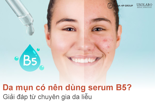 Da mụn có nên dùng serum B5? Giải đáp từ chuyên gia da liễu