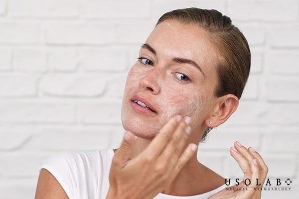 Các bước skincare cho da dầu mụn chuẩn nhất từ chuyên gia