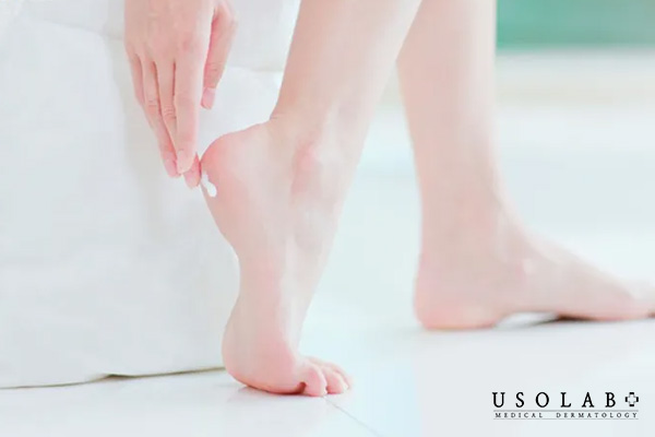 Hướng dẫn dùng kem dưỡng gót chân để đạt hiệu quả nhanh