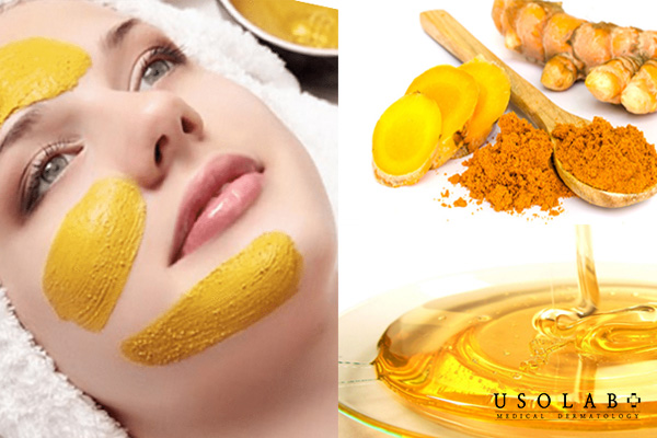 Nghệ và mật ong làm sáng da và mờ thâm hiệu quả