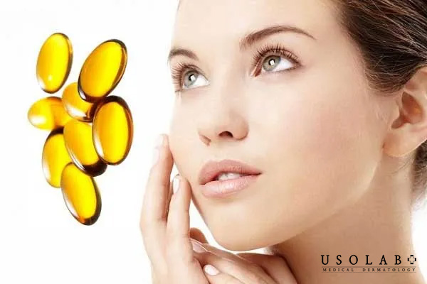 Da dầu mụn nên thận trọng khi sử dụng kem dưỡng vitamin E