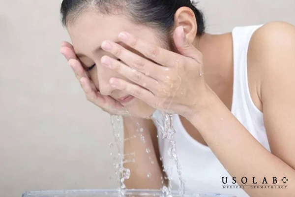 Không nên rửa mặt bằng nước nóng vào mùa đông