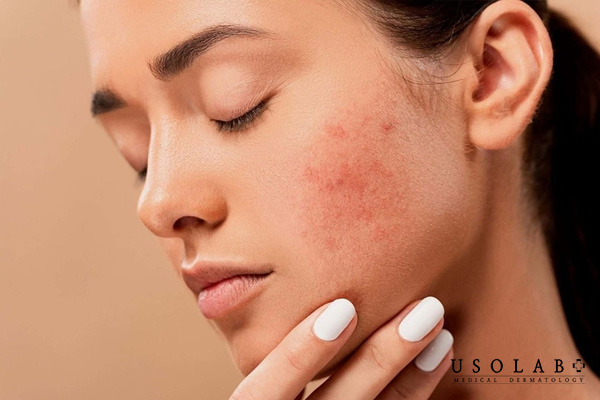 Treatment trong tiếng Việt là điều trị, trị liệu