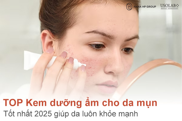 Top 7 kem dưỡng ẩm cho da mụn tốt nhất 2025 giúp da luôn khỏe mạnh