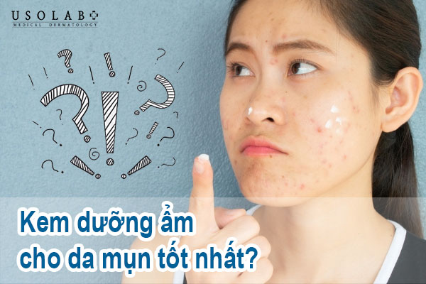 Kem dưỡng ẩm cho da mụn tốt nhất 2025