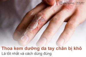 Thoa kem dưỡng da tay chân bị khô vào lúc nào là tốt nhất? Cách dùng đúng