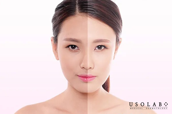 Kem dưỡng da nâng tone giúp dưỡng ẩm và hiệu ứng làm sáng tức thì cho làn da