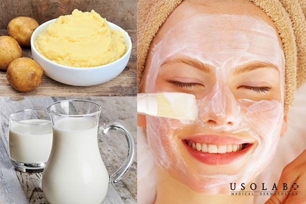 Khoai tây luộc nghiền với sữa tươi làm trắng da mặt