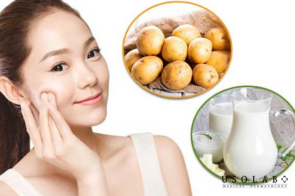 Sữa tươi không đường và khoai tây giúp làm sáng da tự nhiên