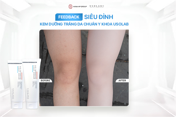 phản hồi khách hàng