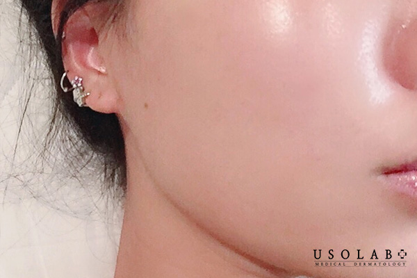 Quan tâm đến thời gian giữa serum và kem dưỡng để đạt được hiệu quả tốt nhất