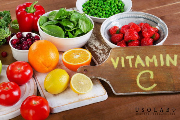 Thực phẩm giàu vitamin C
