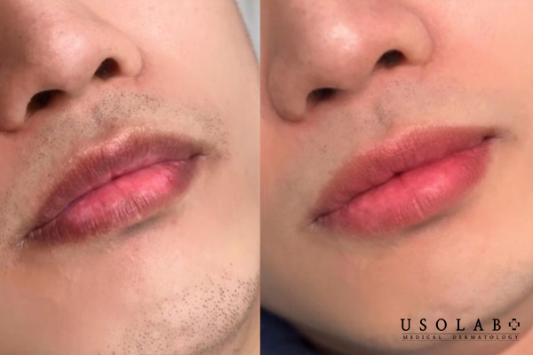 Các tiêu chí chọn kem dưỡng môi phù hợp với nam giới