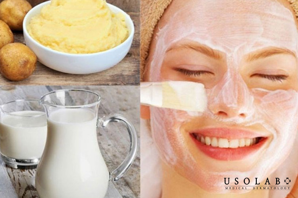Cách ủ trắng da tại nhà bằng sữa tươi không đường và khoai tây