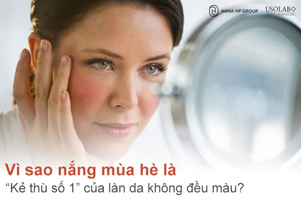 Vì sao nắng mùa hè là “kẻ thù số 1” của làn da không đều màu?