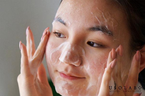 Nên có các thành phần hyaluronic acid, niacinamide, axit salicylic