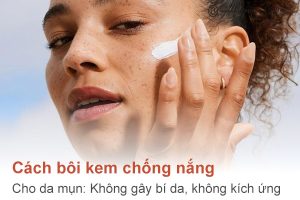 Cách bôi kem chống nắng cho da mụn: Không gây bí da, không kích ứng