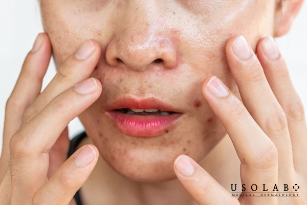 Nên trọn các sản phẩn có độ pH phù hợp