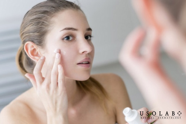 Da mụn nên sử dụng kem chống nắng có chỉ số SPF từ 30 trở lên