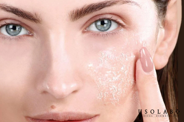 Hành trình phục hồi của làn da sau peel