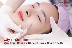 lấy nhân mụn