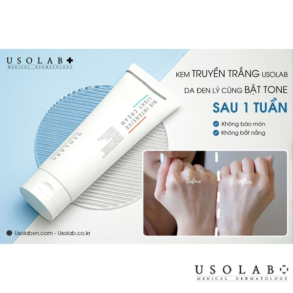 mỹ phẩm trị nám cho spa