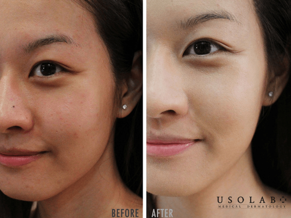 so sánh retinol và tretinoin cho bác sĩ da liễu