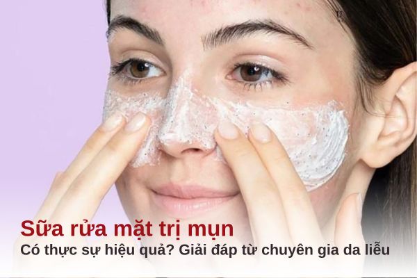 sữa rửa mặt trị mụn