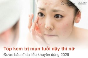 Top kem trị mụn tuổi dậy thì nữ được bác sĩ da liễu khuyên dùng 2025